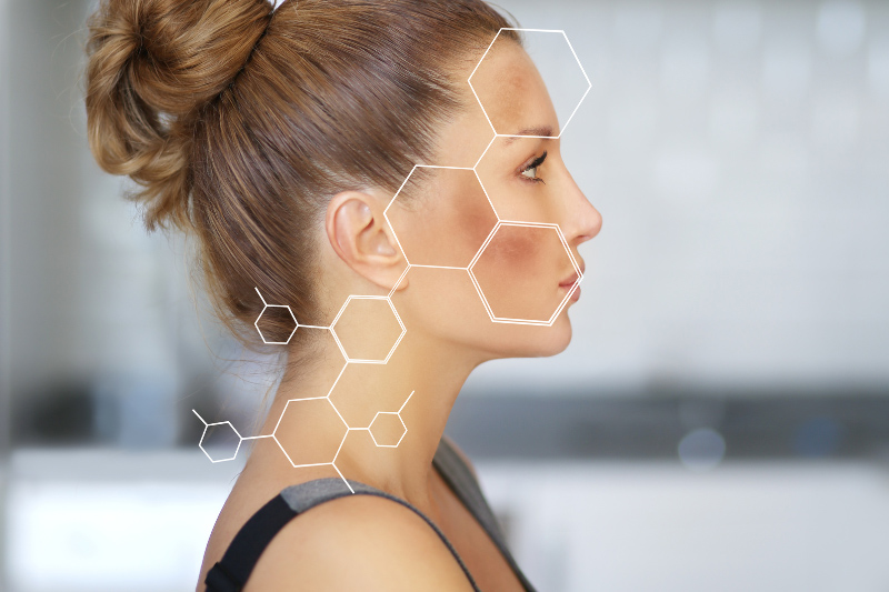 kako ukloniti fleke na licu