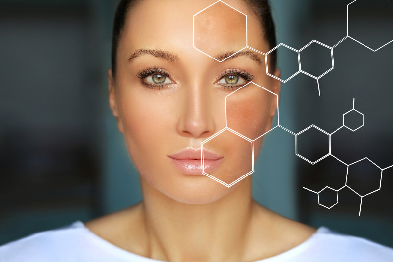 Fleke na licu – uzroci, vrste i kako ih ukloniti